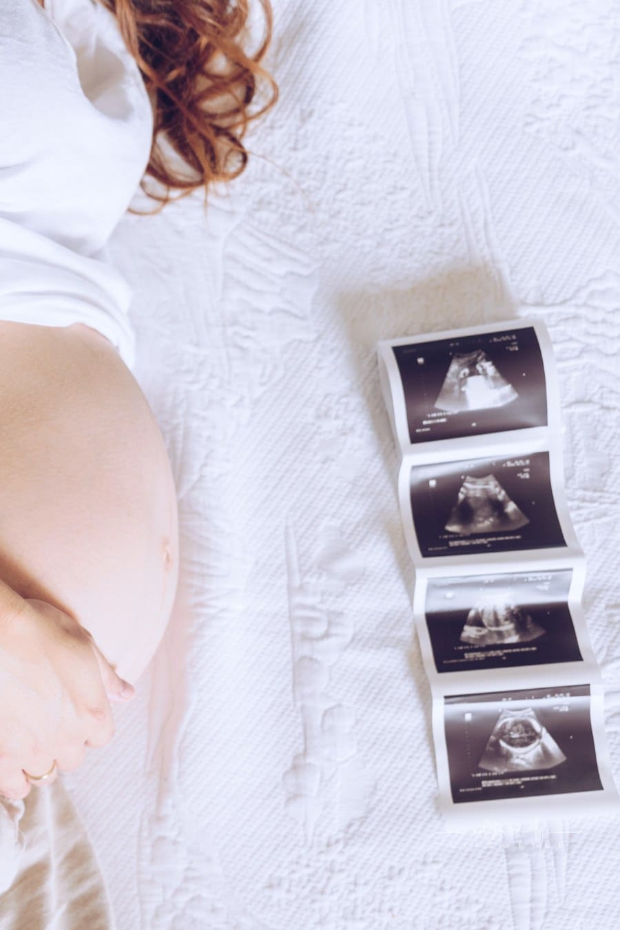 Pregnant Woman with the Sonogram on the Bed