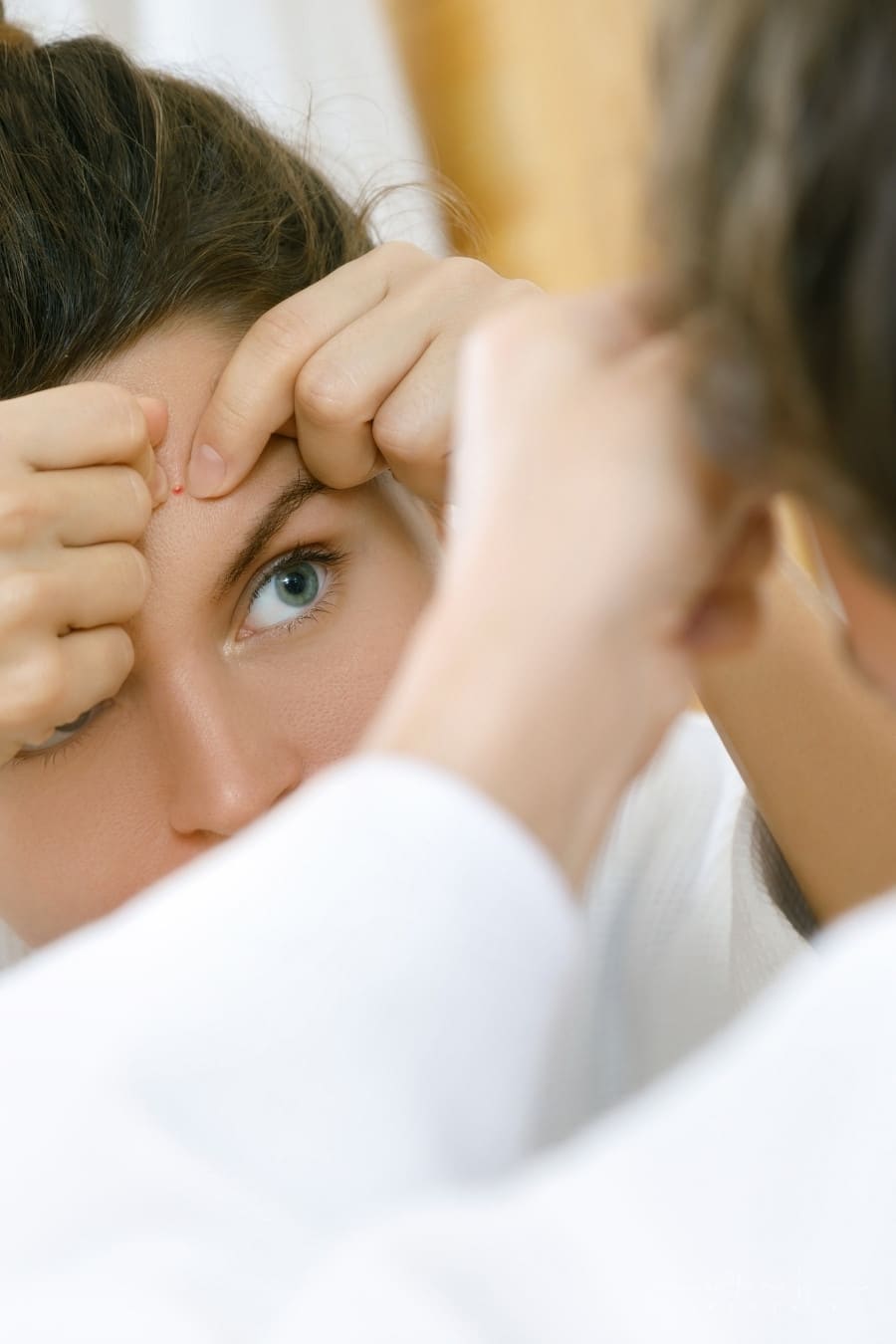 Teenage Acne How To Help Your Child To Deal With It In a Healthy Way