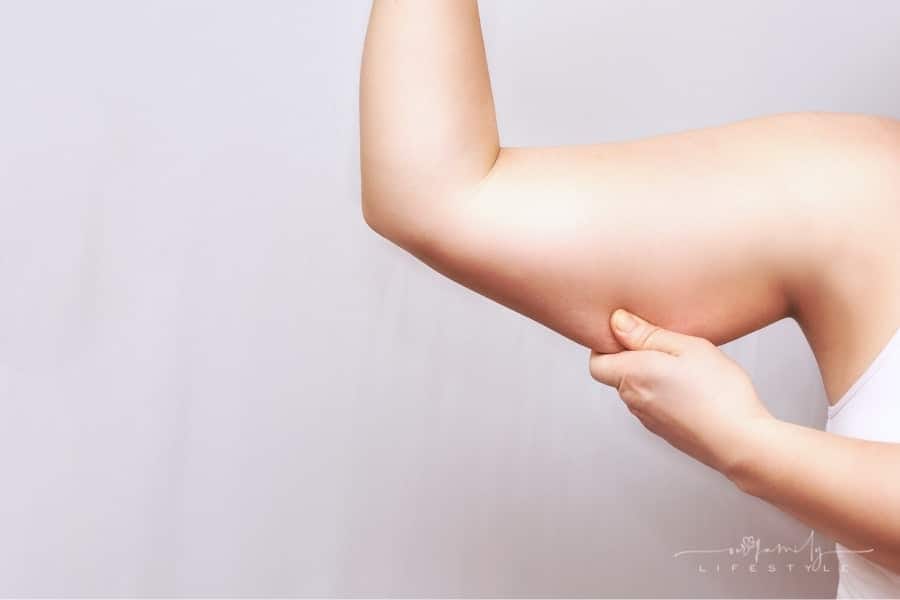 How To Deal With Excess Skin After Weight Loss