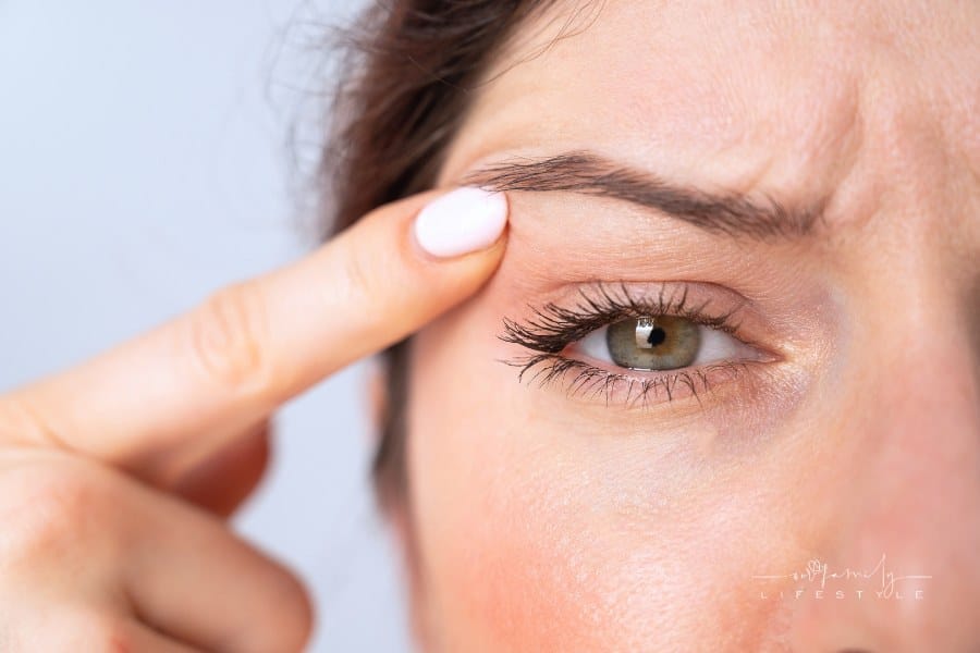 Close-up Portrait of Caucasian Middle-Aged Woman Pointing to the Wrinkles on the Upper Eyelid. Signs of Aging on the Face